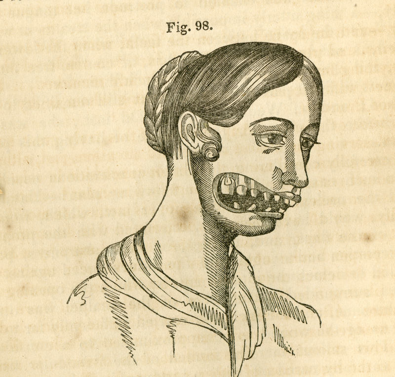 Illustration for article titled A Grisly But Fascinating Tale of the Greatest Medical Revolutionary